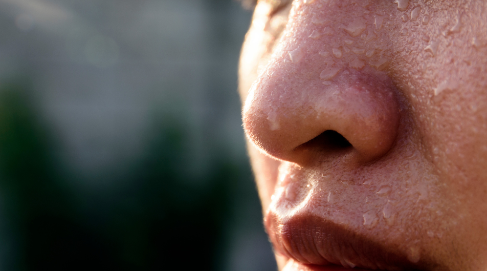 Sudorazione eccessiva in estate: cause, rimedi e quando preoccuparsi Sudorazione eccessiva in estate: cause, rimedi e quando preoccuparsi
